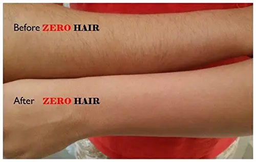Crema depiladora Before after